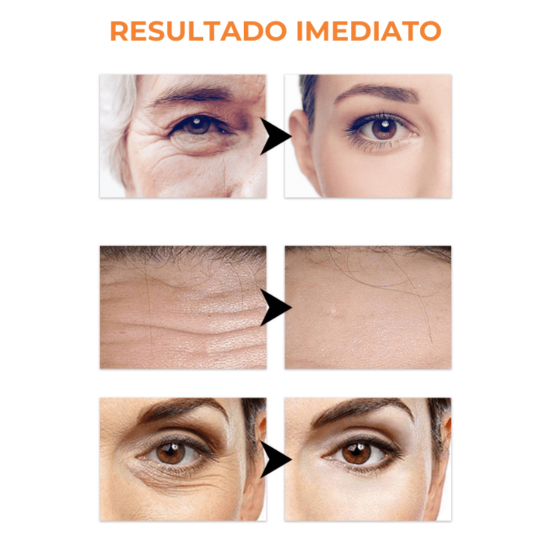 RejuvaColl | 1+1 GRATIS | Kollagen Hud Botox