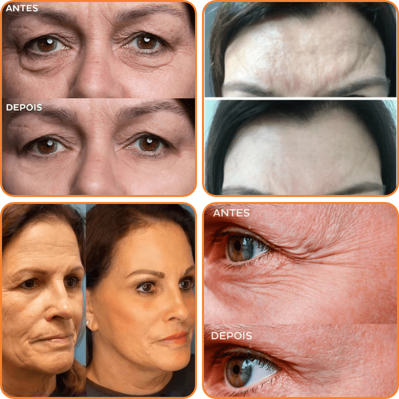 RejuvaColl | 1+1 GRATIS | Kollagen Hud Botox