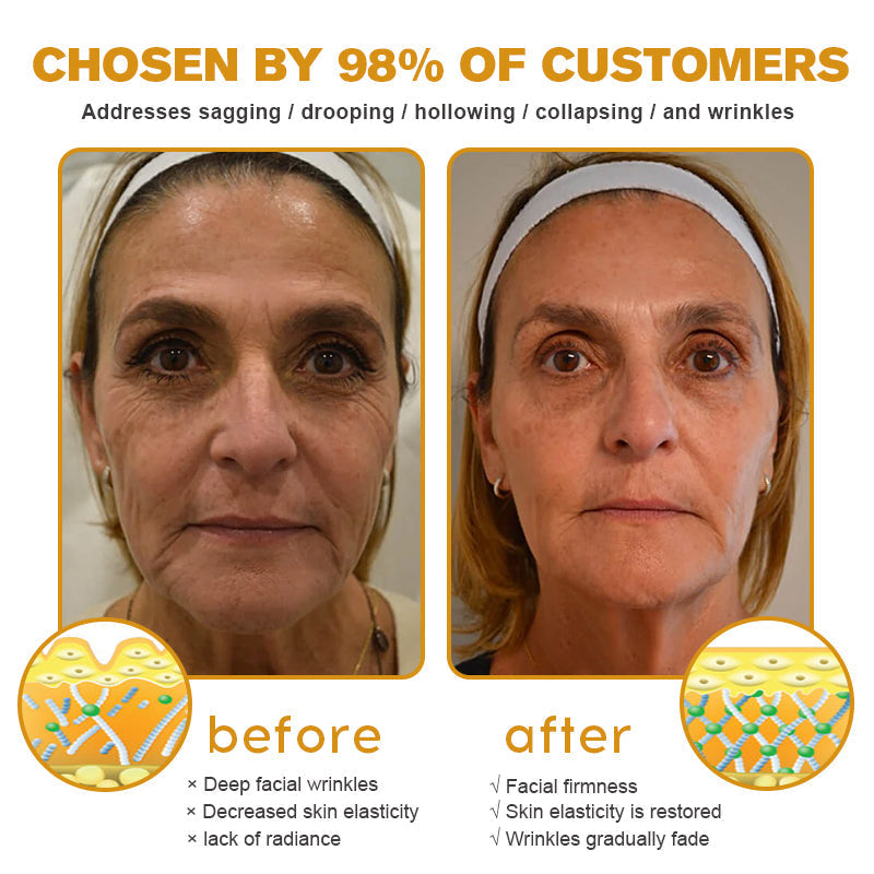 Furzero Botox | Bienengift Faltenentfernungscreme