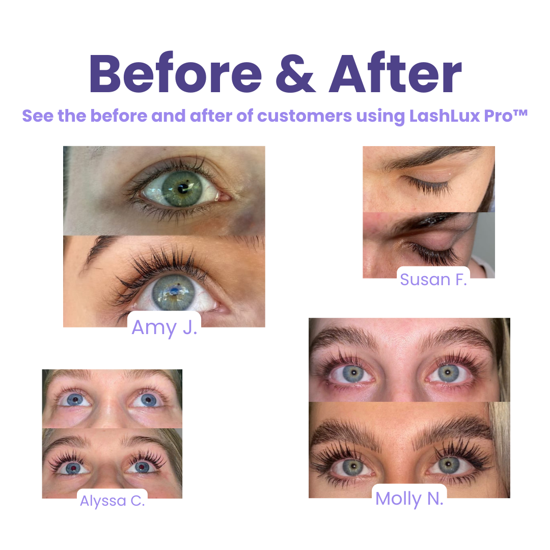 EmberLuxe Pro Wimpernserum